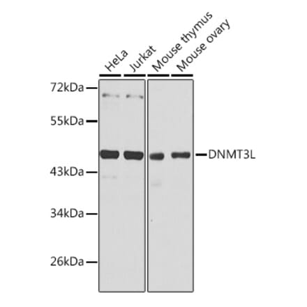 Western Blot - Anti-Dnmt3L Antibody (A89974) - Antibodies.com