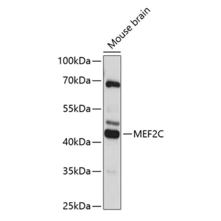 Western Blot - Anti-MEF2C Antibody (A89975) - Antibodies.com