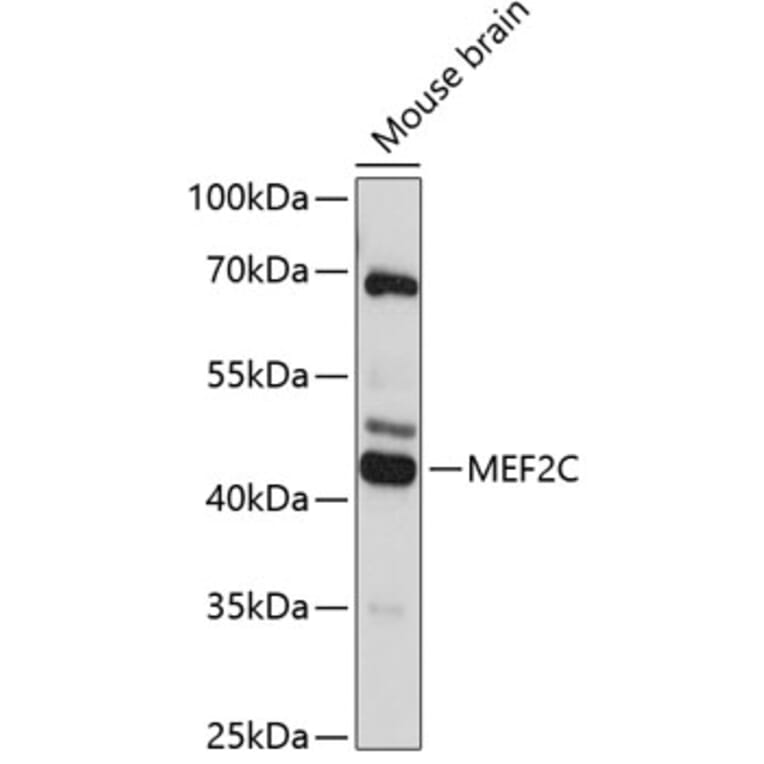 Western Blot - Anti-MEF2C Antibody (A89975) - Antibodies.com