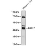 Western Blot - Anti-MEF2C Antibody (A89975) - Antibodies.com