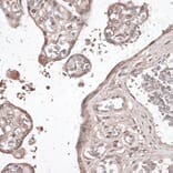 Immunohistochemistry - Anti-MEF2C Antibody (A89975) - Antibodies.com