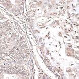 Immunohistochemistry - Anti-MEF2C Antibody (A89975) - Antibodies.com