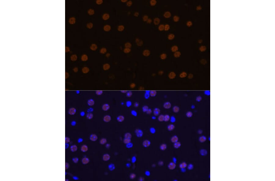 Immunofluorescence - Anti-MEF2C Antibody (A89975) - Antibodies.com