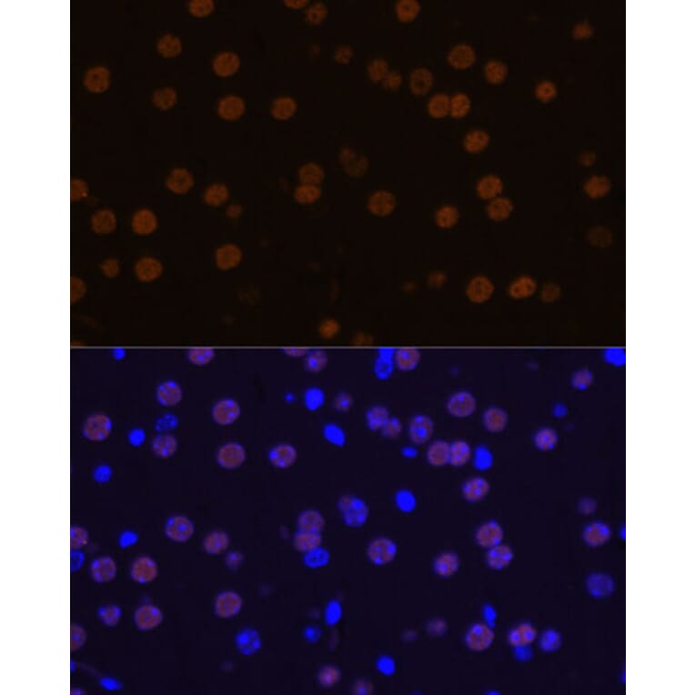 Immunofluorescence - Anti-MEF2C Antibody (A89975) - Antibodies.com