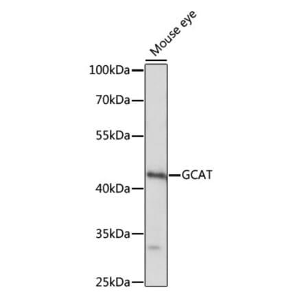 Western Blot - Anti-GCAT Antibody (A89976) - Antibodies.com