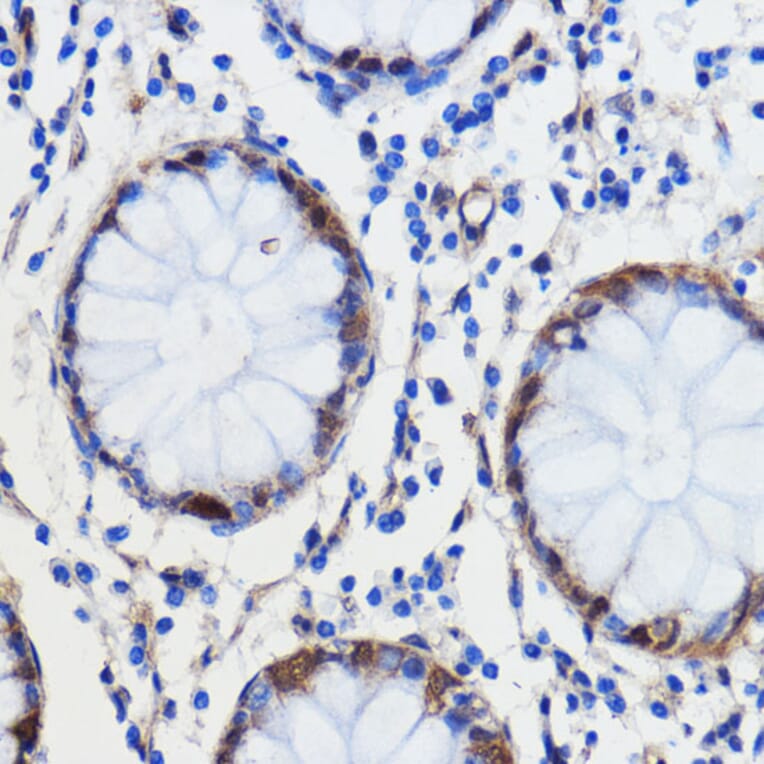 Immunohistochemistry - Anti-GCAT Antibody (A89976) - Antibodies.com
