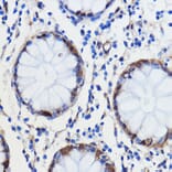 Immunohistochemistry - Anti-GCAT Antibody (A89976) - Antibodies.com