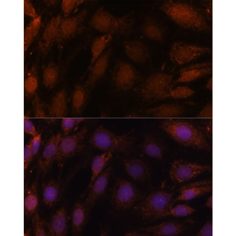 Immunofluorescence - Anti-GCAT Antibody (A89976) - Antibodies.com