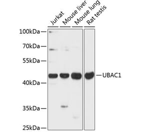 Western Blot - Anti-KPC2 Antibody (A89977) - Antibodies.com