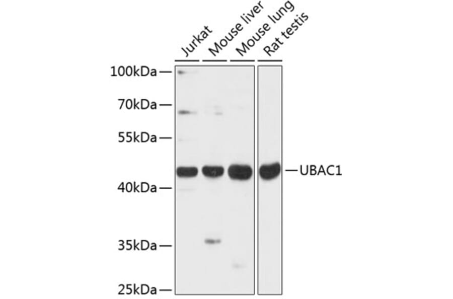 Western Blot - Anti-KPC2 Antibody (A89977) - Antibodies.com