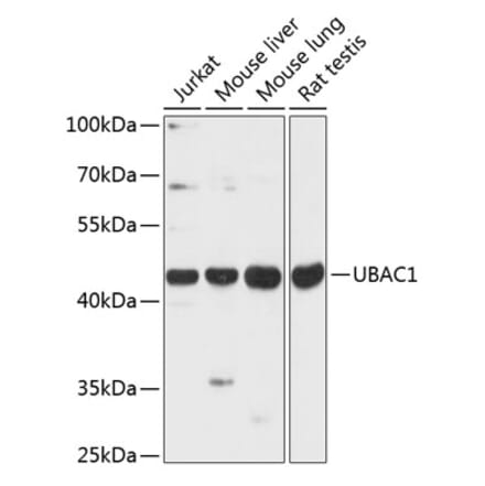 Western Blot - Anti-KPC2 Antibody (A89977) - Antibodies.com