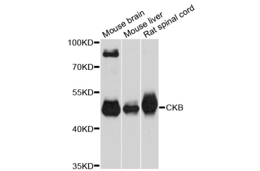 Western Blot - Anti-CKB Antibody (A12632) - Antibodies.com