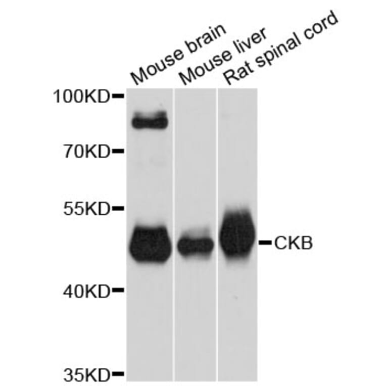 Western Blot - Anti-CKB Antibody (A12632) - Antibodies.com