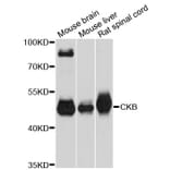 Western Blot - Anti-CKB Antibody (A12632) - Antibodies.com