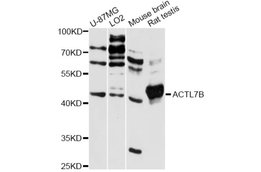 Western Blot - Anti-ACTL7B Antibody (A13149) - Antibodies.com