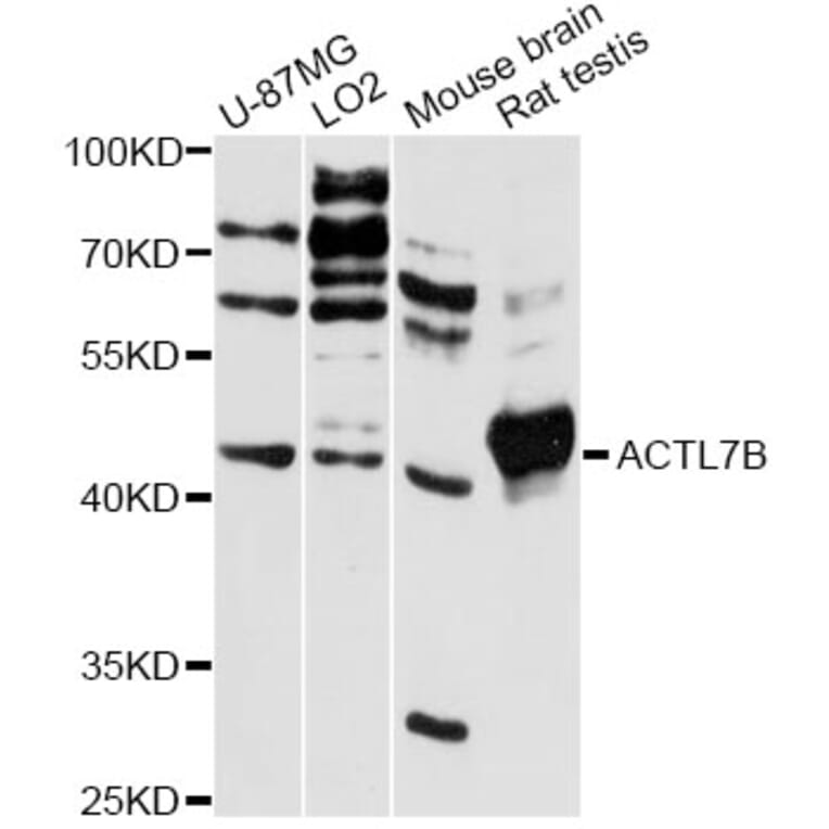 Western Blot - Anti-ACTL7B Antibody (A13149) - Antibodies.com