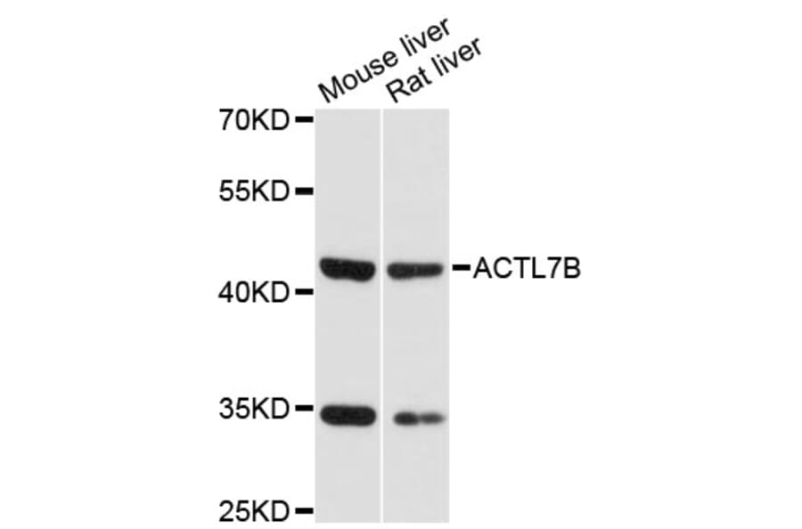 Western Blot - Anti-ACTL7B Antibody (A13146) - Antibodies.com