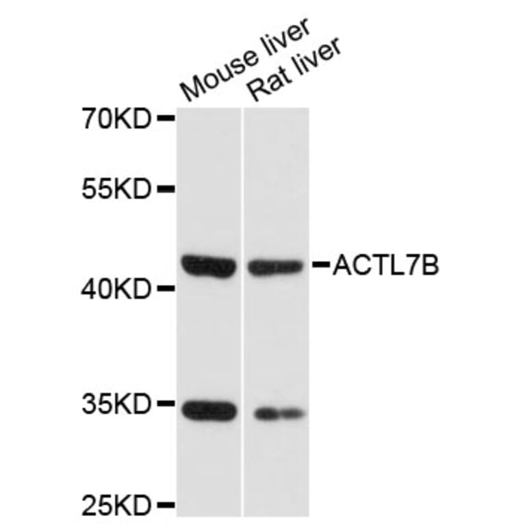 Western Blot - Anti-ACTL7B Antibody (A13146) - Antibodies.com