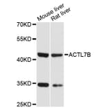 Western Blot - Anti-ACTL7B Antibody (A13146) - Antibodies.com