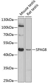 Western blot analysis of extracts of various cell lines, using Anti-SPAG8 Antibody (A8943) at 1:3000 dilution.
Secondary antibody: Goat Anti-Rabbit IgG (H+L) (HRP) (AS014) at 1:10,000 dilution.
Lysates / proteins: 25µg per lane.
Blocking buffer: 3% non-fat dry milk in TBST.
Detection: ECL Basic Kit (RM00020).
Exposure time: 90s.