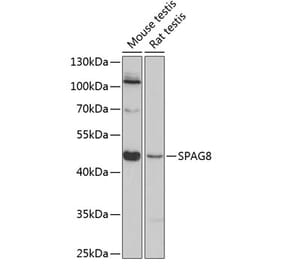 Western Blot - Anti-SPAG8 Antibody (A89981) - Antibodies.com