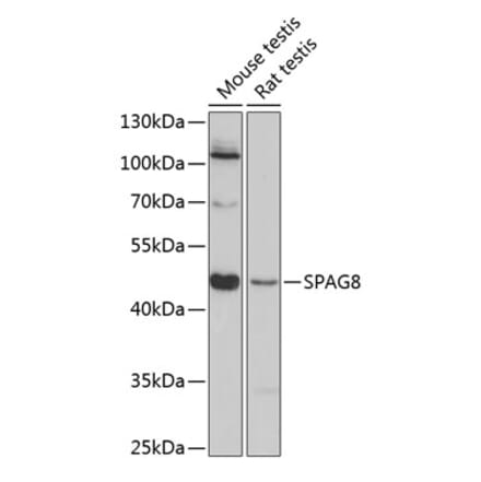 Western Blot - Anti-SPAG8 Antibody (A89981) - Antibodies.com