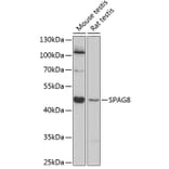 Western Blot - Anti-SPAG8 Antibody (A89981) - Antibodies.com