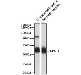 Western Blot - Anti-GPA33 Antibody (A89982) - Antibodies.com