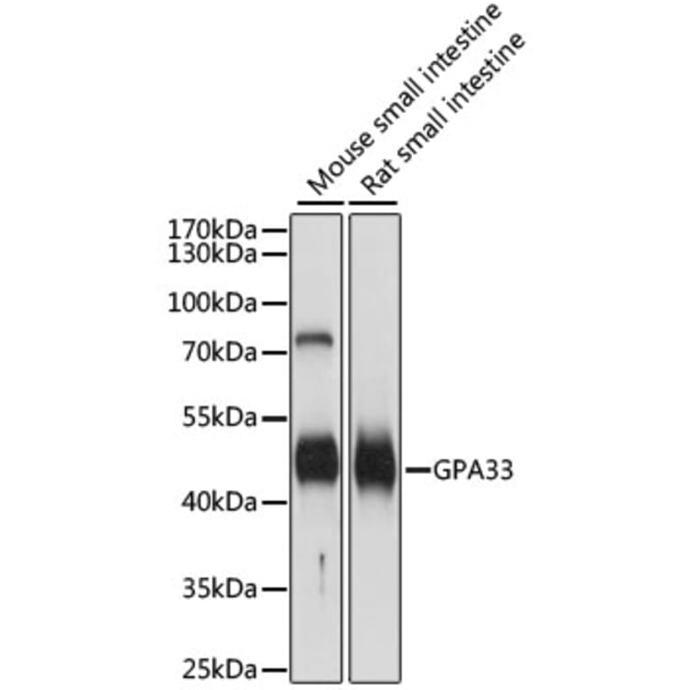 Western Blot - Anti-GPA33 Antibody (A89982) - Antibodies.com