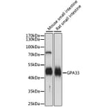 Western Blot - Anti-GPA33 Antibody (A89982) - Antibodies.com