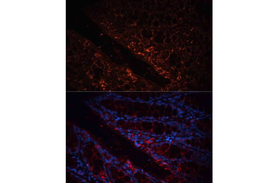Immunofluorescence - Anti-GPA33 Antibody (A89982) - Antibodies.com