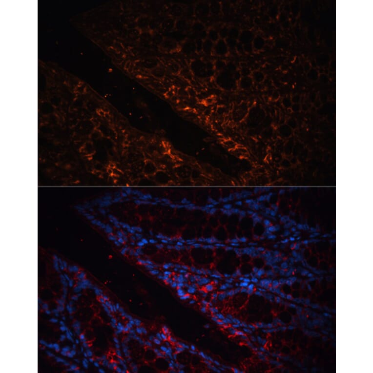 Immunofluorescence - Anti-GPA33 Antibody (A89982) - Antibodies.com