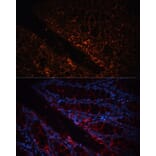 Immunofluorescence - Anti-GPA33 Antibody (A89982) - Antibodies.com