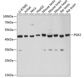 Western Blot - Anti-PGK2 Antibody (A89983) - Antibodies.com