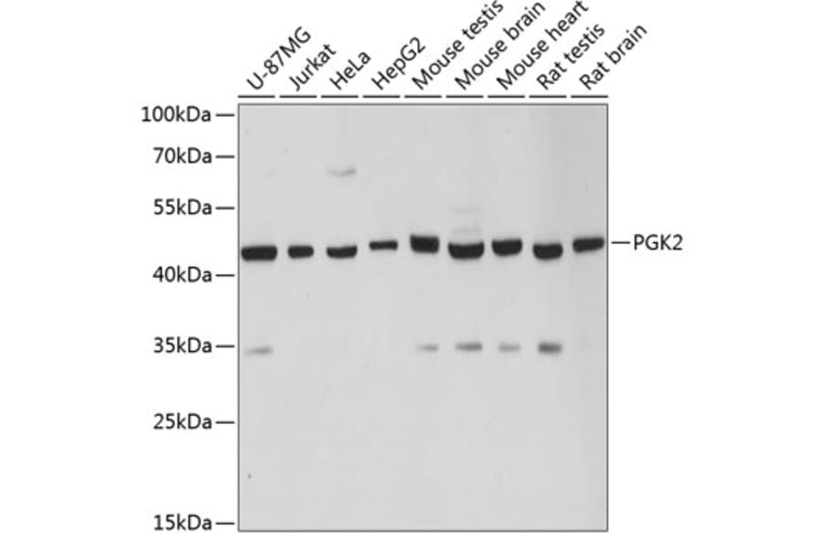 Western Blot - Anti-PGK2 Antibody (A89983) - Antibodies.com
