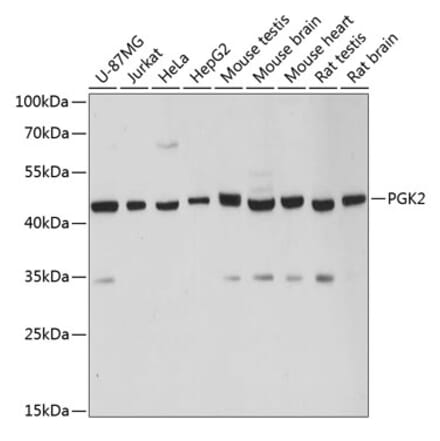Western Blot - Anti-PGK2 Antibody (A89983) - Antibodies.com