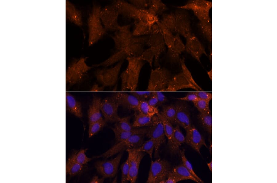 Immunofluorescence - Anti-PGK2 Antibody (A89983) - Antibodies.com