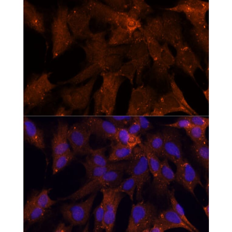Immunofluorescence - Anti-PGK2 Antibody (A89983) - Antibodies.com