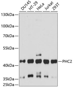 Western blot analysis of extracts of various cell lines, using Anti-PHC2 Antibody (A14610) at 1:3000 dilution.
Secondary antibody: Goat Anti-Rabbit IgG (H+L) (HRP) (AS014) at 1:10,000 dilution.
Lysates / proteins: 25µg per lane.
Blocking buffer: 3% non-fat dry milk in TBST.
Detection: ECL Basic Kit (RM00020).
Exposure time: 90s.