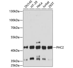 Western Blot - Anti-PHC2 Antibody (A89984) - Antibodies.com