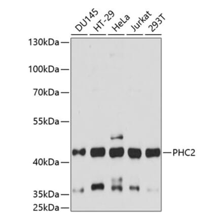 Western Blot - Anti-PHC2 Antibody (A89984) - Antibodies.com