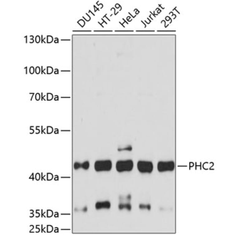 Western Blot - Anti-PHC2 Antibody (A89984) - Antibodies.com