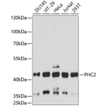 Western Blot - Anti-PHC2 Antibody (A89984) - Antibodies.com