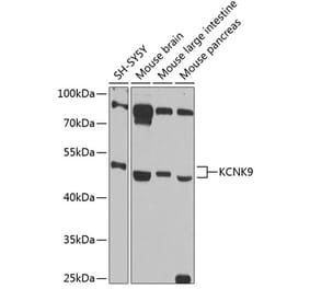 Western Blot - Anti-KCNK9 Antibody (A89985) - Antibodies.com