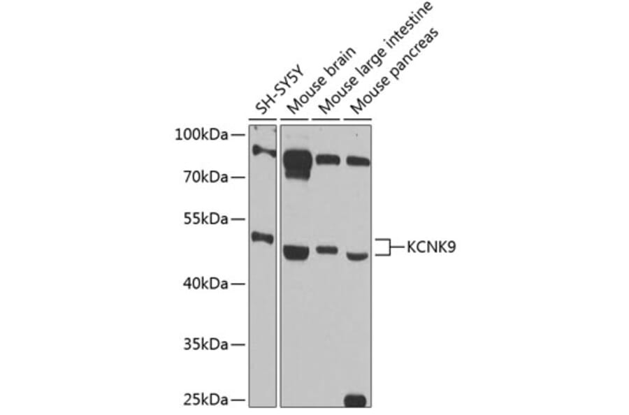 Western Blot - Anti-KCNK9 Antibody (A89985) - Antibodies.com