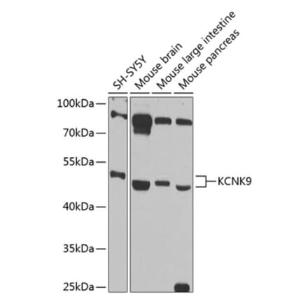 Western Blot - Anti-KCNK9 Antibody (A89985) - Antibodies.com