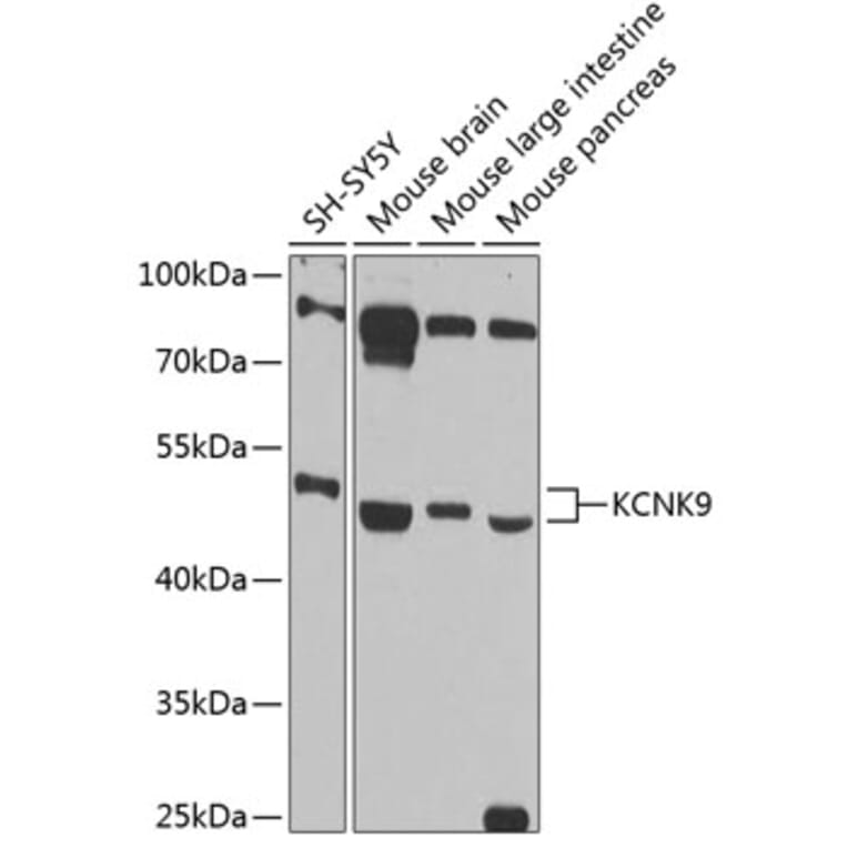 Western Blot - Anti-KCNK9 Antibody (A89985) - Antibodies.com