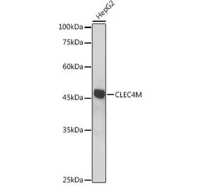Western Blot - Anti-DC-SIGNR Antibody (A89986) - Antibodies.com