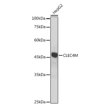 Western Blot - Anti-DC-SIGNR Antibody (A89986) - Antibodies.com