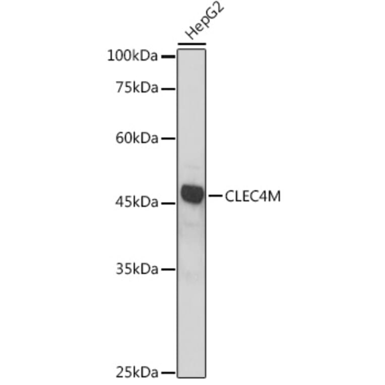 Western Blot - Anti-DC-SIGNR Antibody (A89986) - Antibodies.com